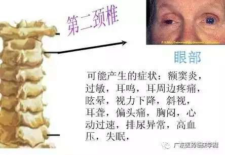 泛亚电竞官方入口-脊椎与全身的疾病对应关系，太精准了！(图3)