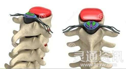 颈椎，为何为“百病之源”“博鱼·体育中国入口”(图4)