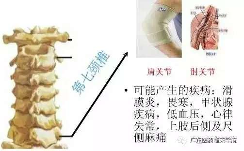 脊椎与全身的疾病对应关系，太精准了！_半岛官方下载地址(图8)